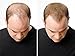 ESPIRITU DE CANELA CINNAMON SPIRIT OIL MEN WOMEN HAIR LOSS BALDING REGROWTH TREATMENT by Pharmark