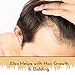 Duke's Beard Growth Serum Refill - Stimulate Beard and Hair Growth