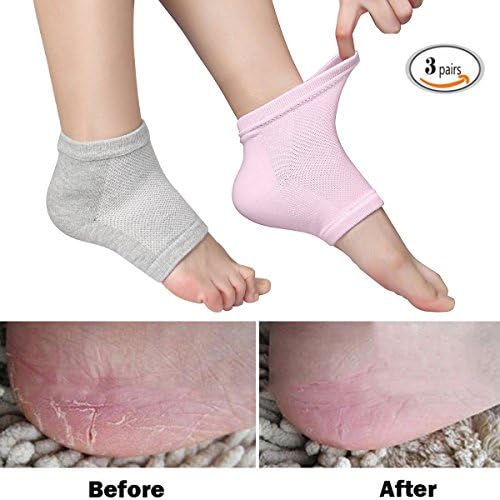 Easybuystore Vented Moisturizing Gel Heel Socks Day Night Toe Open Feet Care Sets Ultimate Treatment for Dry Hard Cracked Skin with Spa Quality Botanical Gel Pack of 3 Pairs