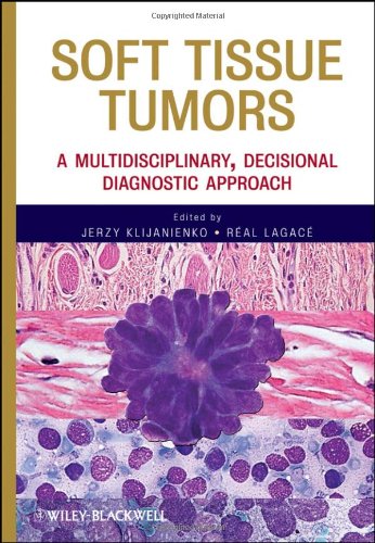Soft Tissue Tumors - A Multidisciplinary, Decisional Diagnostic Approach
