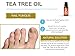 Tea Tree Oil by AromaOils - Pure Therapeutic Grade Melaleuca Oil - 1 fl oz (30 ml) - Best for Skin Tag Removal, Nail Fungus Treatment, Aromatherapy, Scented Massage Oil, Acne Reducer, Facial Toner (Package may vary)