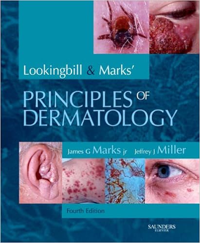 lookingbill and marks principles of dermatology lookingbill and marks principles of dermatology