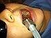 Kona Adapter 2.0 Kit - Attach **Isolite** Dental Mouthpieces Directly to your HVE valve
