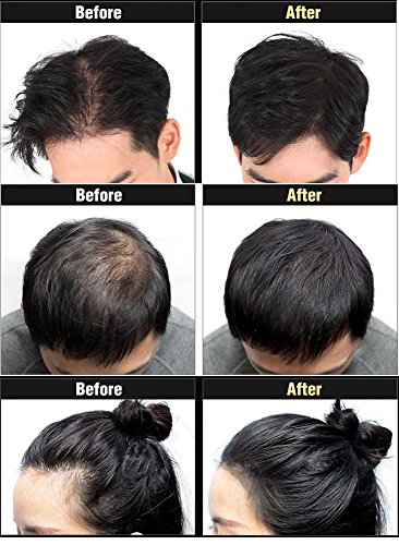 DASHU Anti-Hair Loss Hair Cushion Hair Concealer Hair Building Fibers Black / Dark Brown / Light Brown (26g, Light Brown)