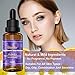 Hyaluronic Acid Serum, Anti Aging Anti Wrinkle Serum, Face Moisturizer Hydrating Serum with Vitamin C, Vitamin E Helps Improve Skin Texture & Balance, Non-greasy, 1oz/30ml