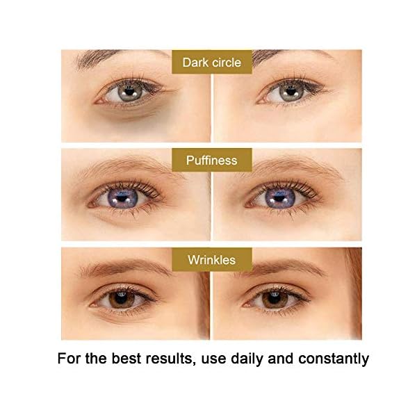 Eye-CreamEye-GelAnti-Aging-Eye-Cream-Minimizes-Fine-Lines-Reduces-Puffiness-Dark-Circles-Anti-Aging-Skin-Nourishes-Skin-Fights-Wrinkles-Night-and-Day-Moisturizing-Cream Eye Cream,Eye Gel,Anti-Aging Eye Cream - Minimizes Fine Lines, Reduces Puffiness & Dark Circles, Anti Aging Skin…