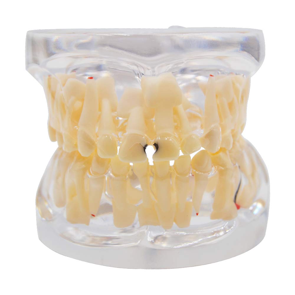 Get Amazon Com Children S Permanent Tooth Alternation Model Of For Android Free Wallpaper Amazon Com Children S Permanent Tooth Alternation Model Of For Android