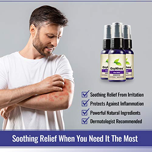 OxyHives Soothing Hives Relief Best Natural Hive Treatment with 100