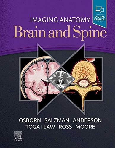 ExpertDDx: Brain and Spine: 9780443106941: Medicine & Health