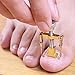 Pevor Ingrown Toe Nail Correction Tool Pedicure Tool Nail Orthosis Armor Corrector Tool (Ingrown Toenail Tool)