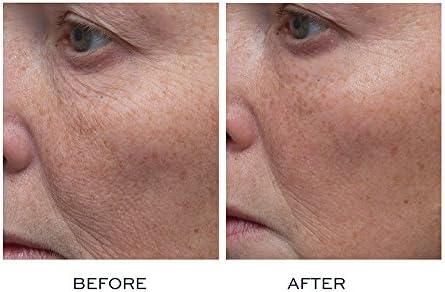 elemis before and after