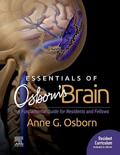 Amazon.com: Osborn's Brain E-Book eBook : Osborn MD, FACR, Anne G