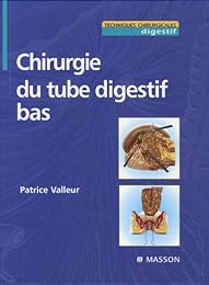 Chirurgie du tube digestif bas