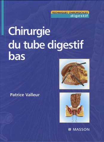 Chirurgie du tube digestif bas