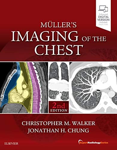 Diagnostic Imaging: Chest: 9780323796637: Medicine & Health