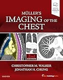 Muller's Imaging of the Chest: Expert Radiology