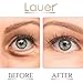 Lauer Under Eye Bags Treatment Patches | Eye Mask with Hyaluronic acid and SNAIL Slime Extract | Puffy Eyes | Dark Circles Under Eye Treatment Masks