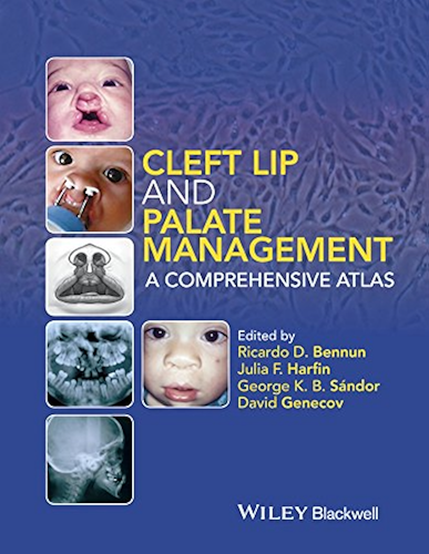 Download Cleft Lip and Palate Management: A Comprehensive Atlas (English Edition) PDF
