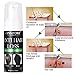 BUOCEANS Hair Growth Products, Hair Regrowth, Hair Growth Treatment, Hair Loss & Hair Thinning Treatment, Extra Strength Hair Growth Treatment Foam, One Month Supplythumb 2