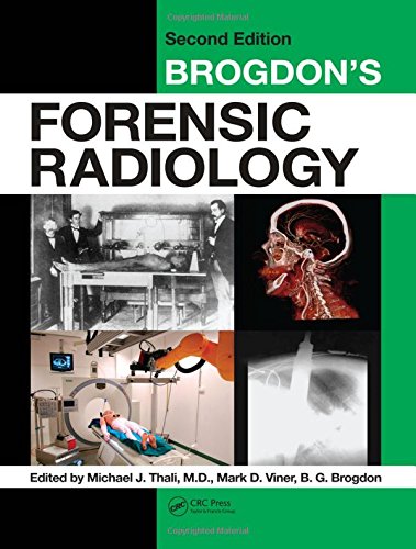 Brogdon's Forensic Radiology Brogdon's Forensic Radiology