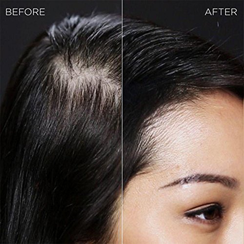 IMMETEE Keratin Hair Building Fibers Powder Conceal Instantly for Thinning Hair,Cover Up Hair Loss Natural Thickens for Men and Women-25g/0.88oz (GRAY)