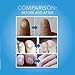 Fungus Treatment, Fungus Stop, Anti Fungus Nail Treatment, Effective Against Nail Fungus, Anti Fungal Nail Solution, Toenails & Fingernails Solution, 2pcs