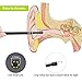 ITHILDINS Video Otoscope,Ear Wax Remover, 2 in 1 USB OTG, No Color, Size No Size