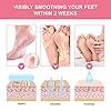 3-Pack-Foot-Peel-Mask-Foot-Peel-Mask-for-hard-skin-Remove-callus-peel-and-dead-skin-foot-mask-Foot-remover-membrane-suit-foot-peeling-mask-Peeling-Care-Rose 3 Pack Foot Peel Mask, Foot Peel Mask for hard skin, Remove callus peel and dead skin foot mask, Foot remover membrane…