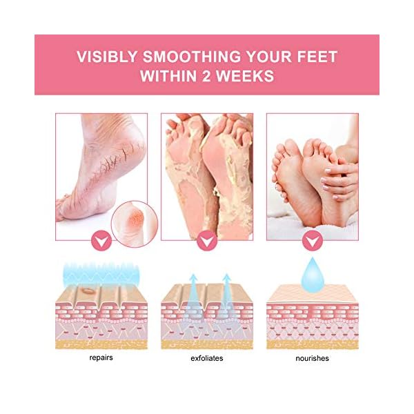 3-Pack-Foot-Peel-Mask-Foot-Peel-Mask-for-hard-skin-Remove-callus-peel-and-dead-skin-foot-mask-Foot-remover-membrane-suit-foot-peeling-mask-Peeling-Care-Rose 3 Pack Foot Peel Mask, Foot Peel Mask for hard skin, Remove callus peel and dead skin foot mask, Foot remover membrane…