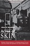 Acres of Skin: Human Experiments at Holmesburg Prison cover