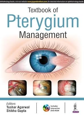 Textbook of Pterygium Management