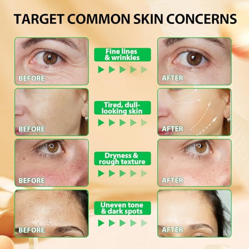 Pure Vitamin E, 100% Natural Vitamin E Oil for Skin, Organic Vitamin E Oil 75,000 IU, for Scars and Stretch Marks, Hydration of Dry Skin and Reduces Wrinkles, Firming Skin, 60 ml