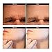Skincareguys Stretch Marks & Acne Scars and Hair Loss with 540 Pins Skin Cleaning System Personal Beauty Tool For Home Use 0.5