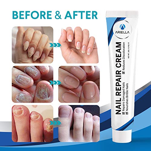 Ariella Toenail Fungus Stop Nail Repair Cream, Repairs and Protects