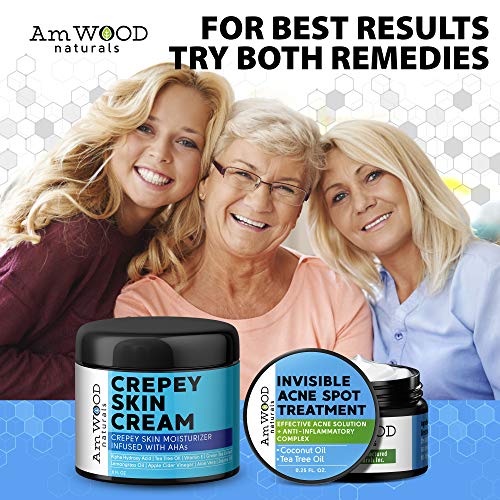 Acne Spot Treatment Cream - Made in USA - Fast-Acting Formula for Clearing Severe Acne from Face & Body - Effective & Invisible Cystic Acne Cleanser Solution for Teens & Adults