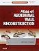 Atlas of Abdominal Wall Reconstruction: Expert Consult - Online and Print