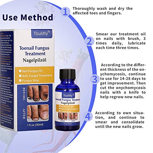 4 Natural+Treatment+Maximum+Strength+Solution