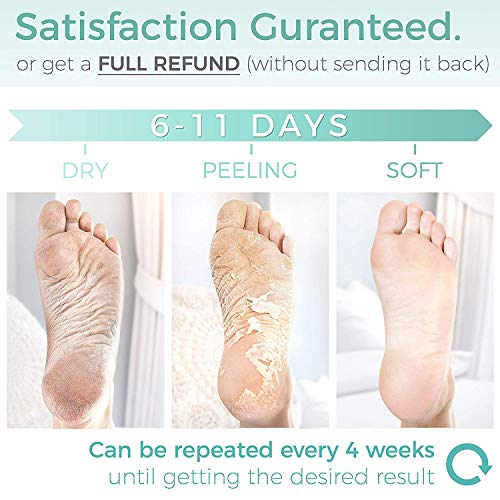 Foot Peel Mask - 2 Pack - For Cracked Heels, Dead Skin and Calluses - Make Your Feet Baby Soft and Get Smooth Silky Skin - Removes Rough Heels, Dry Toe Skin - Natural Treatment - Cruelty-Free and Vegan - Thumbnail 3