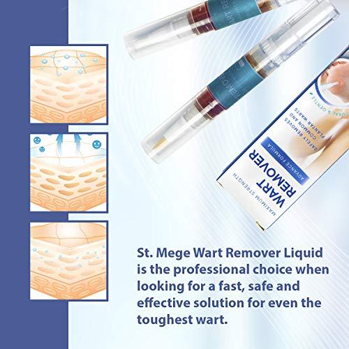 ST. Mege Wart Pen - Maximum Strength - Wart Pen for Flat Warts, Plantar Warts, Common Warts - Corn, Callus - Lightweight - Easy-to-Use - Travel-Friendly