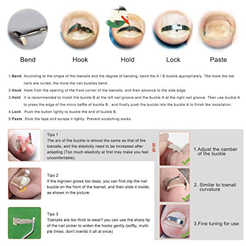 BEZOX Ingrown Toenail Tools, 2PCS Ingrown Toenail Correction Buckle and