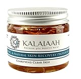 Salicylic Acid 2% & Aloe Acne Clear Skin Treatment 2oz for Face & Body, Teens & Adults