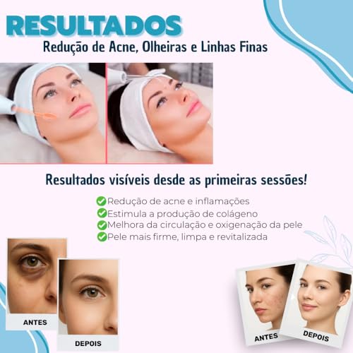 Aparelho de Alta Frequência Portátil Bivolt (110v/220v) com 4 Eletrodos – Facial e Capilar – Estética Profissional para Tratamentos de Pele e Cabelos