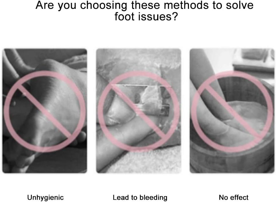 Professional Foot Scrubber - Image 4