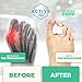 Active 365 Toe Separators for Bunions & Hammer Toes | Gel Toe Spacers & Straightener Splints | 4 Pieces (Medium, White)