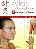 Image de atlas photographique d'acupuncture