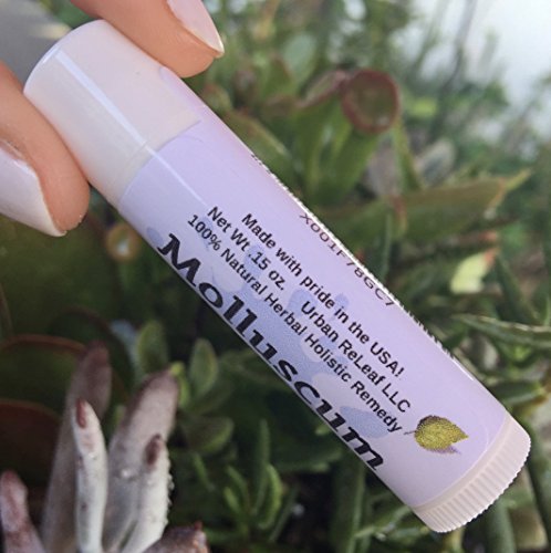 Urban ReLeaf Molluscum Vanishing Stick ! Fast & Painless Help for Molluscum, Verrucas, Warts, Skin Tags. 100% Natural Salve, Topical Cream. Safe for Kids & Delicate Areas."Goodbye Itchy red Bumps!" - Thumbnail 4