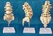 Medical Human Spine Spine Pathology Demonstration Model Anatomical Model Lumbar Vertebrae Sacrum & Coccyx, with Herniation Disc Sold by East dental