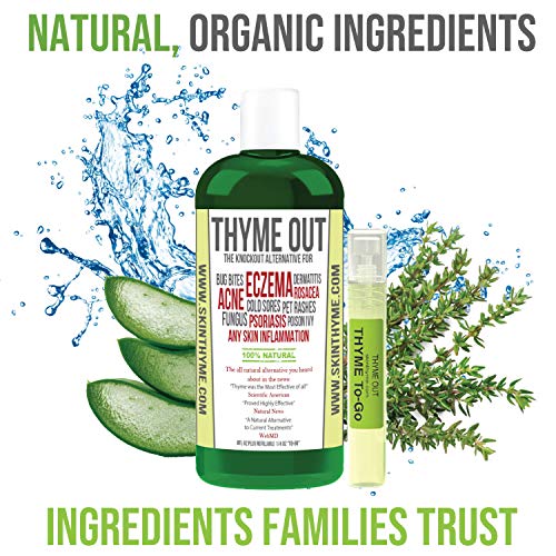Thyme Out Natural Skin Treatment for Eczema Relief, Psoriasis, Acne
