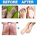 Foot Peel Mask for Baby Soft Feet,Exfoliating Foot Mask for Dead Skin & Callus Remover, Smooth and Healthy Skin,Moisturizing and Nourishing