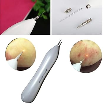 Tattoo Removal Plasma Pen Laser Facial Freckle Black Spot Removal Tool Removal Machine Face Care Beauty Equipment Amazon De Beauty